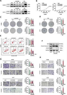 ACSS2 enables melanoma cell survival and tumor metastasis by negatively regulating the Hippo pathway